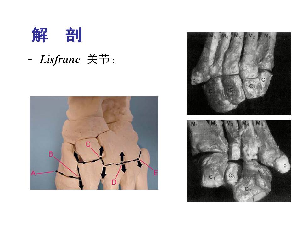 跖跗关节lisfranc损伤的治疗技巧