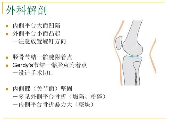 胫骨平台骨折的诊断与治疗