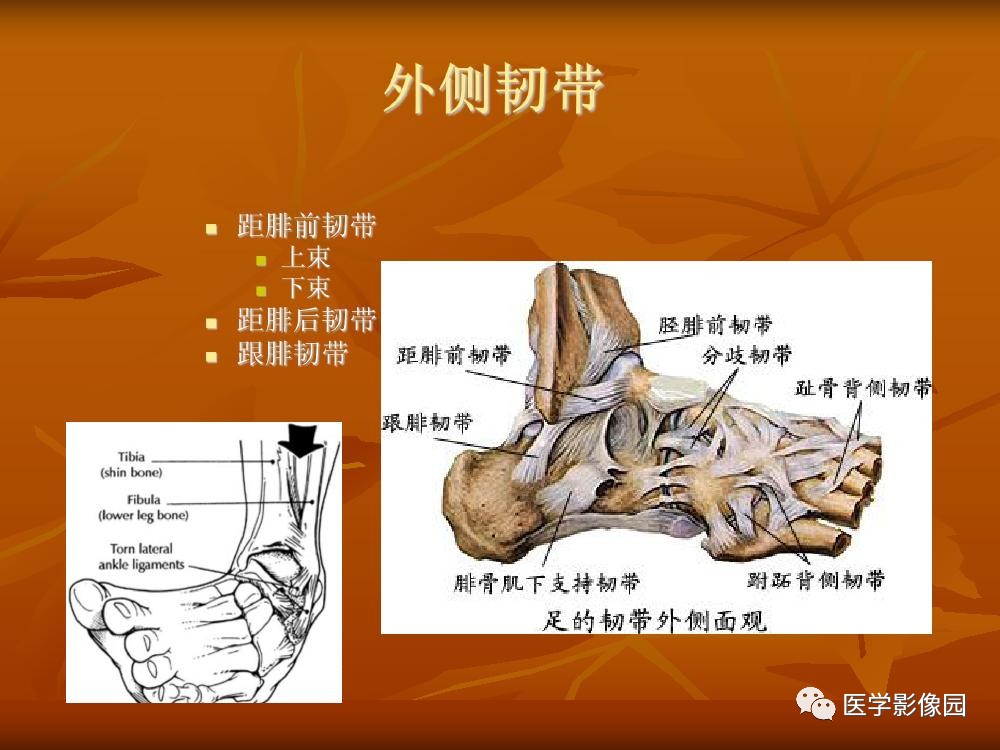 踝关节韧带的解剖及影像表现