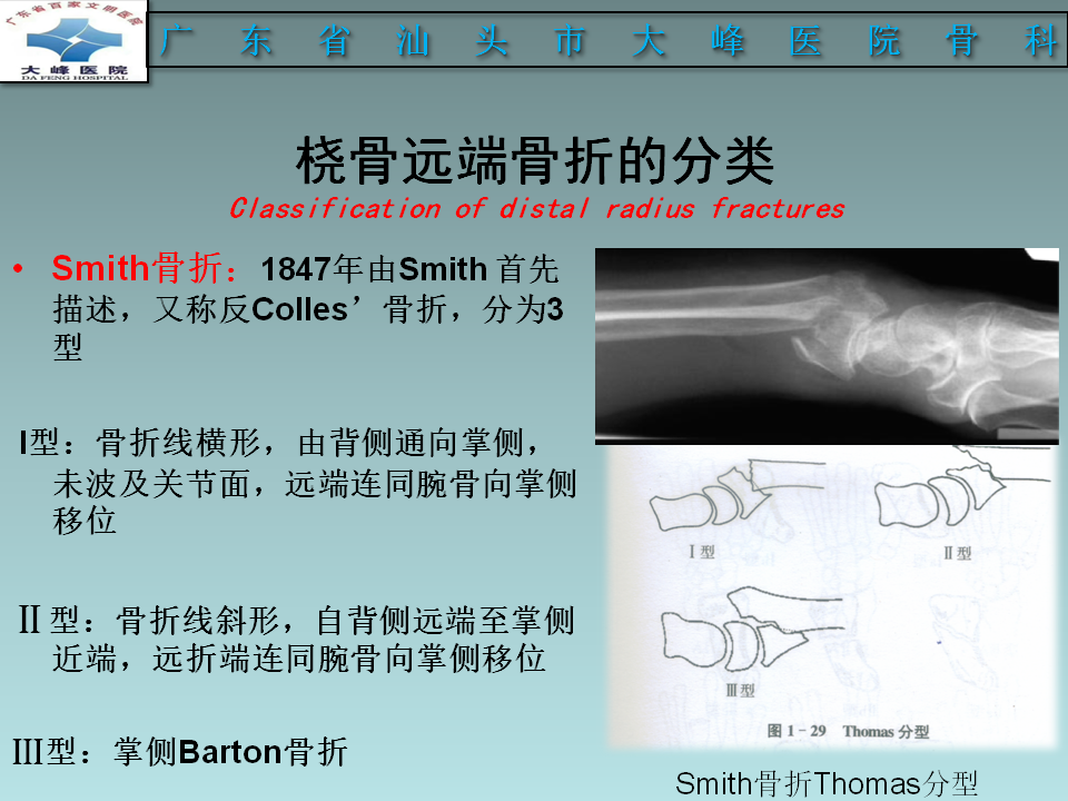 桡骨远端骨折的分型及治疗策略