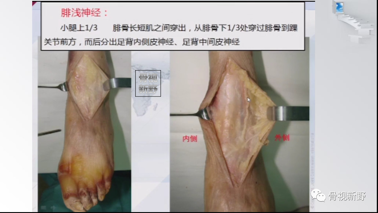 踝关节解剖高清图解,值得收藏!