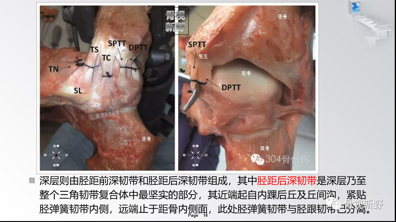 踝关节解剖高清图解,值得收藏!