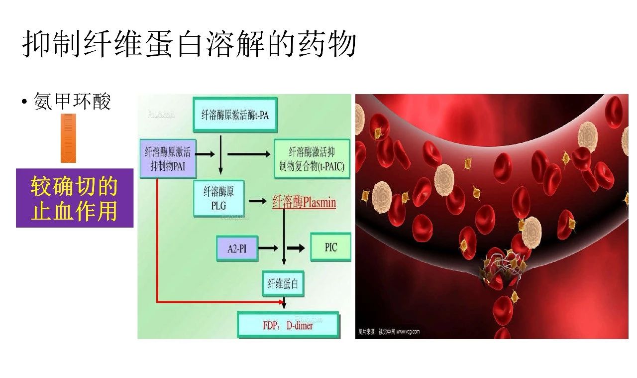 当抗凝遇上出血,如何预防dvt?