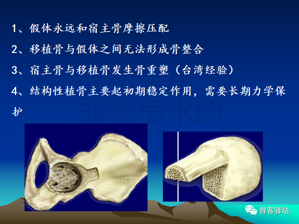 人工髋关节翻修髋臼侧重建旋转中心难点解析