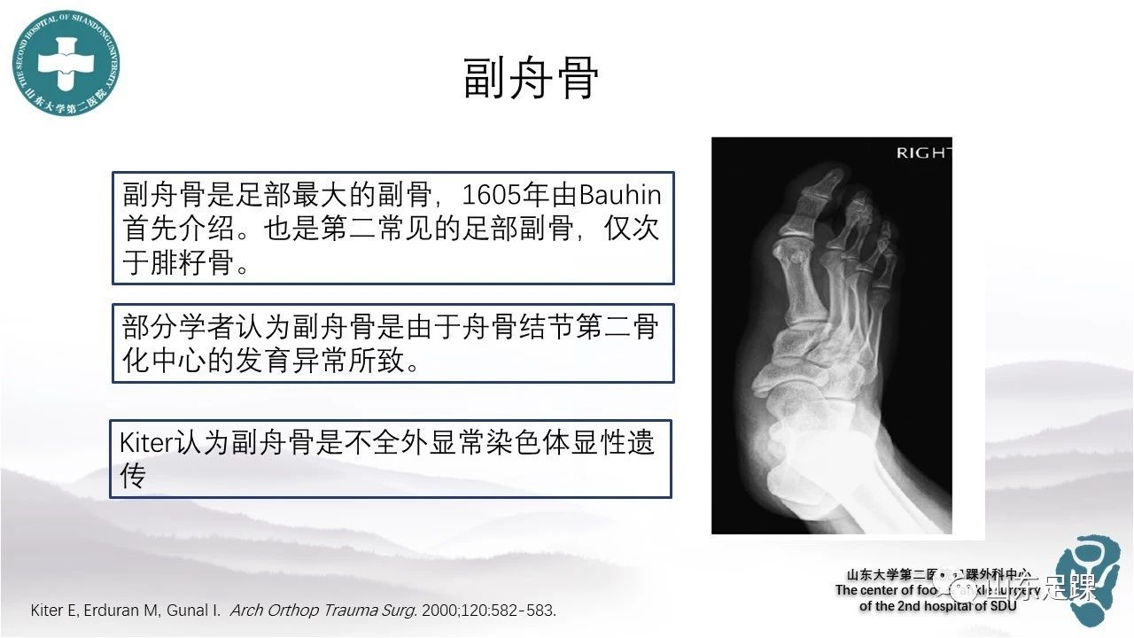 一文详解:副舟骨,胫后肌腱和平足症