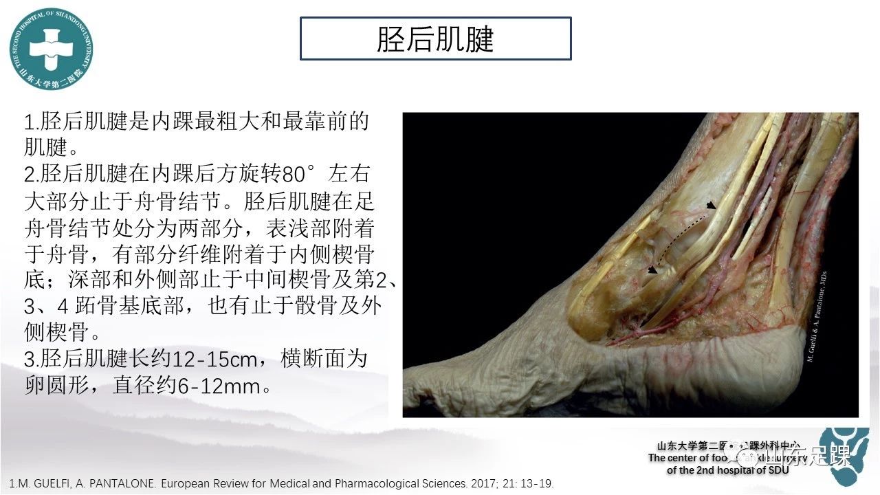 一文详解:副舟骨,胫后肌腱和平足症