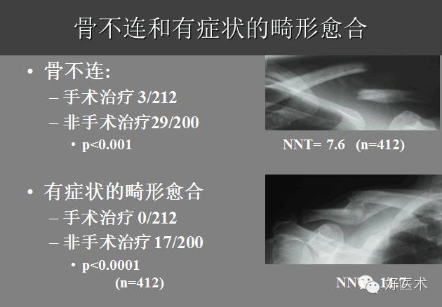 护理后的骨不连发生率 非手术性治疗后的症状性锁骨畸形愈合发生率