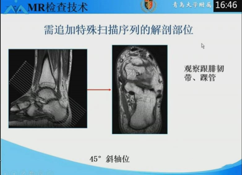 足踝部mri的解剖及诊断要点 好医术早读文章 好医术 赋能医生守护生命