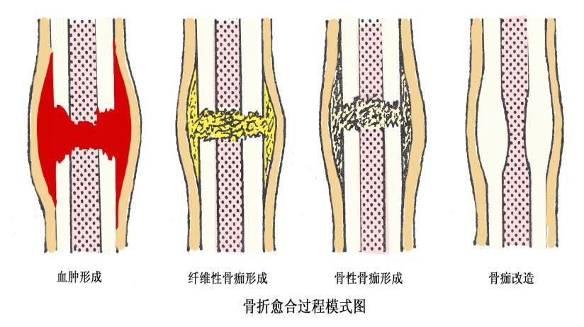 骨科创伤的这些基础知识，你全都掌握了吗？ - 好医术早读文章 - 好医术-赋能医生守护生命