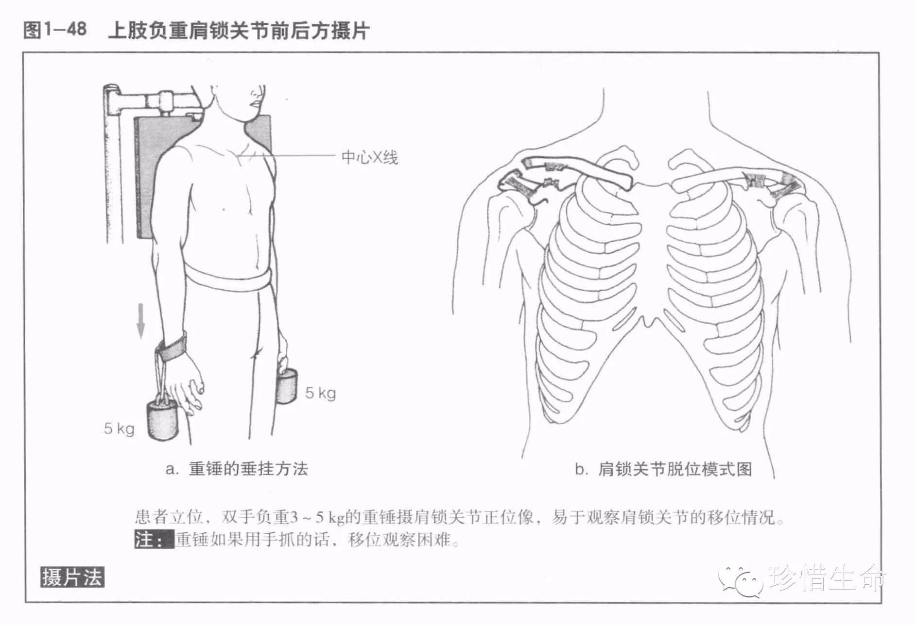 肩关节x线检查体位大全