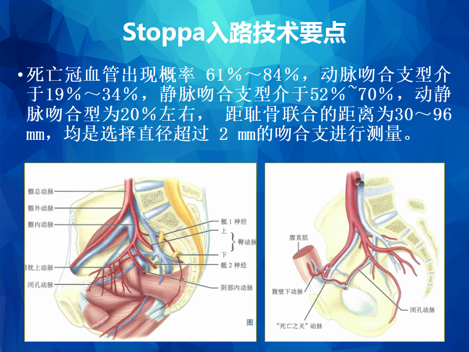 股骨骨折手术入路图谱图片