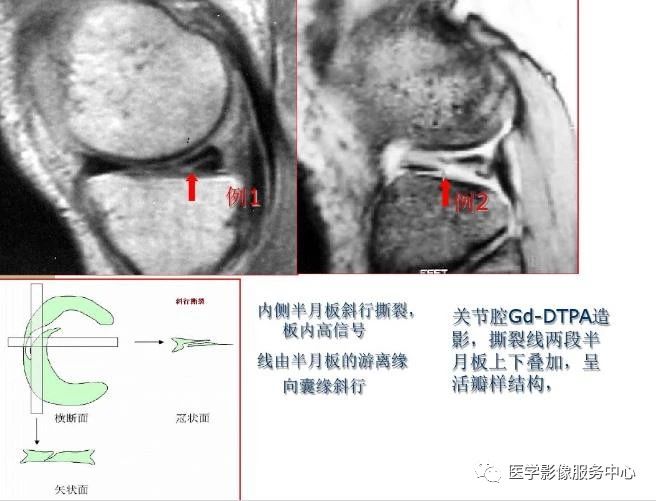 文章详情