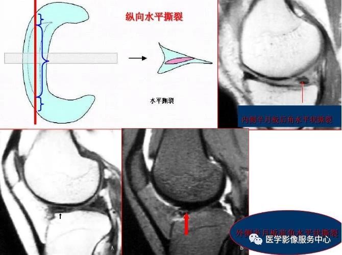 文章详情